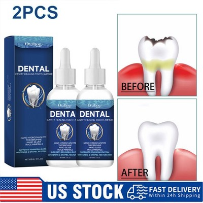 2PCS Dental Cavity Healing Tooth Armor Teeth Care Whitening Enamel Restoration