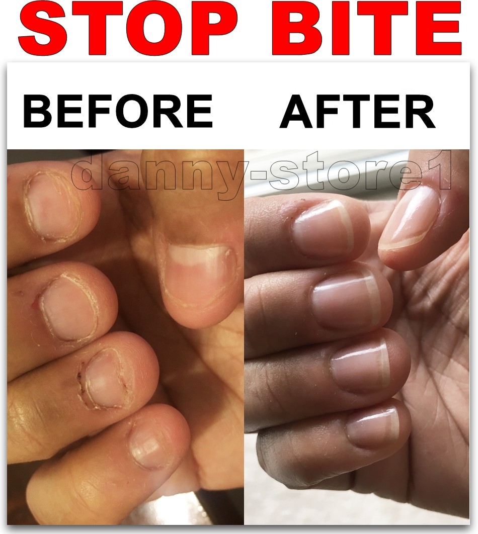 NO BITE,STOP NAIL BITING, Polish Bitter NON TOXIC ,Nail Care with Vit.F