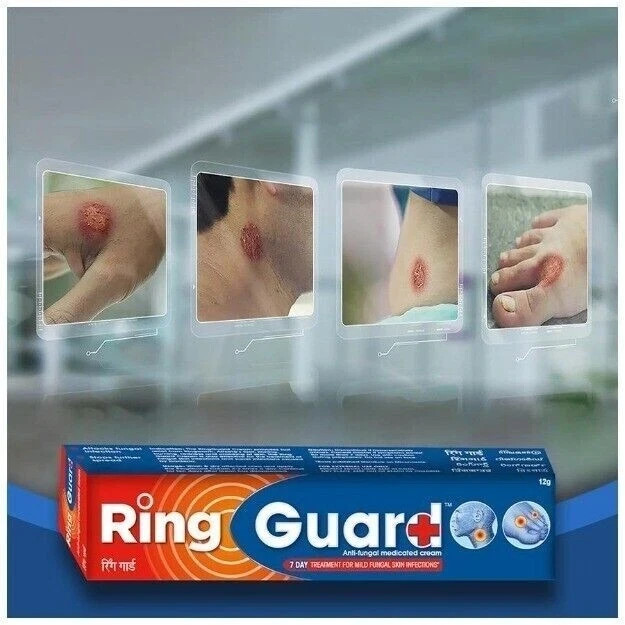 Ring Guard Cream | dermatitis Ringworm ITCHING & REDNESS ATHLETES FOOT 20g x 5