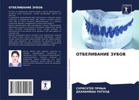 Shrishtee Priya (U. A.) | Otbelivanie Zubov | Taschenbuch | Russisch (2021)