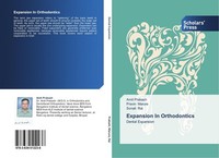 Expansion In Orthodontics Amit Prakash