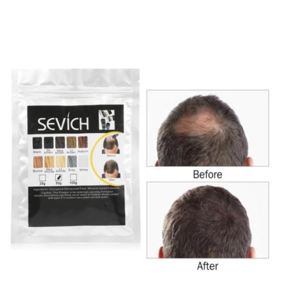 Sevich Refill Hair Fibers Keratin Thickening Building 25,50,100g Pack Fibre Loss