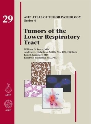 Tumors of the Lower Respiratory Tract - 9781933477466