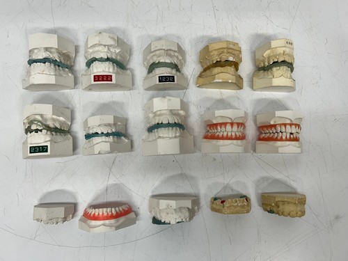 Lot 25 Vtg Dental Plaster Real Tooth Teeth Molds Dentist Cast Impressions #D