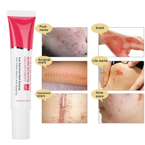 TYJR Scar Removal Cream Face Body Repair Gel Skin Repair Dark Spot Cream 15 AU - Picture 8 of 12