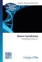 Lydia D. Thomson-Smith | Down Syndrome | Taschenbuch | Englisch (2026)