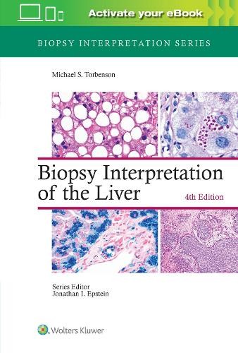 Biopsy Interpretation of the Liver by Michael Torbenson - 9781975157296