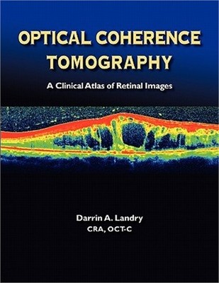 Optical Coherence Tomography a Clinical Atlas of Retinal Images (Paperback or So