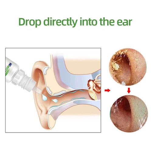 10ml Ear Drops Sodium Bicarbonate Earwax Cleaner Liquid Ears Caring - Picture 2 of 11