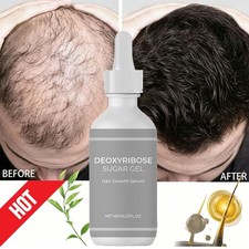 Deoxyribose Sugar Gel Hair Growth, Deoxyribose Serum for Hair Loss 60ml USA