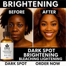 Kojic Acid skin lightening serum 30ml