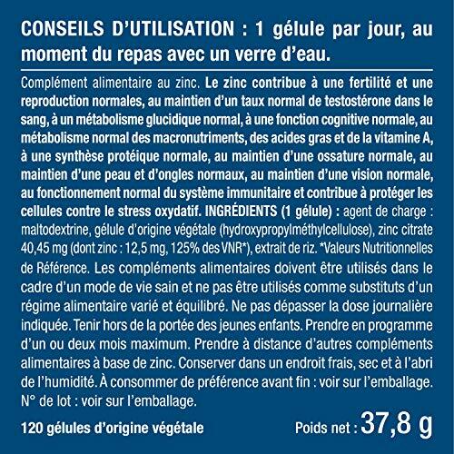 Coques de Rétroviseurs Carbone - Audi A4 S4 RS4