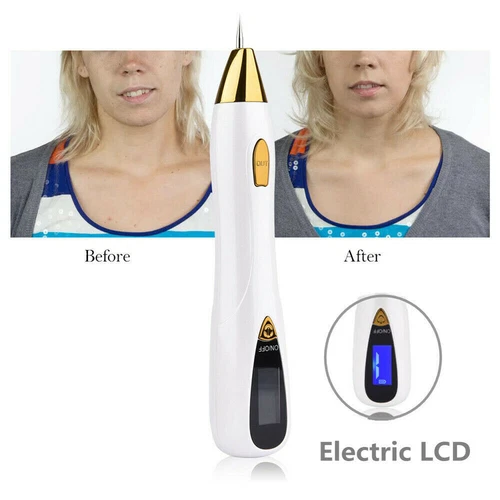 Facial Care LCD Plasma Pen Wrinkle Scar Tattoo Pigment Removal Beauty Machine - Picture 6 of 10