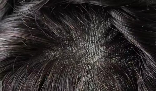 parrucca toupè patch cutanea 100% capelli veri naturali scegli il tuo colore - Foto 2 di 12