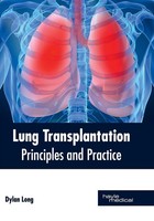 Dylan Long | Lung Transplantation | Buch | Englisch (2017) | Gebunden