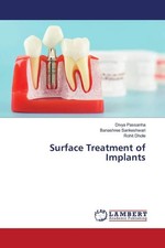 Divya Passanha (u. a.) | Surface Treatment of...