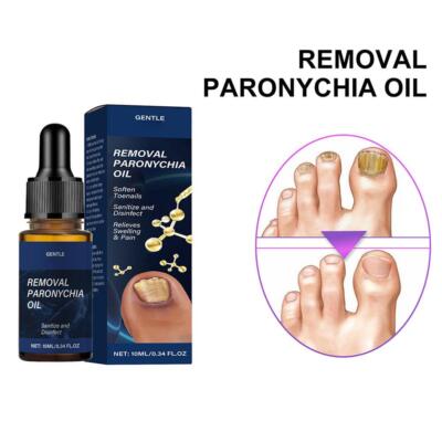 1*10ml Eingewachsene Zehennagel Behandlung Infektion Nagelpflege Öl Entfernung Paronychie Best