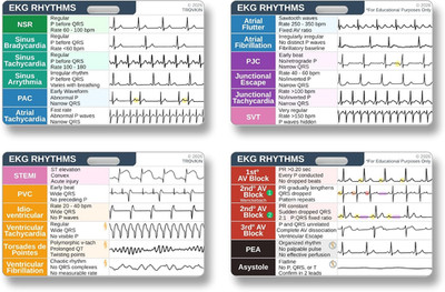 EKG Rhythm Interpretation Badge Card Set with 24 Common Cardiac Rhythms
