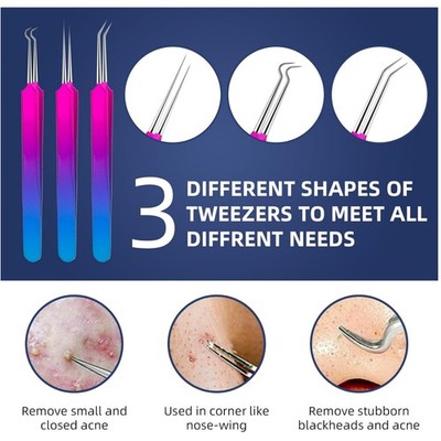 Blackhead Remover Kit - Professional 10 Pcs Set