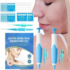 Auto Micro Skin Tag Remover Device Kit Safe Painless Removal 2-8 mm Band Tool us