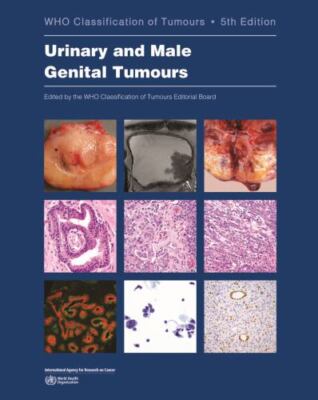 Urinary and Male Genital Tumours, Paperback by Who Classification of Tumours ...