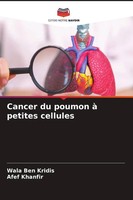 Wala Ben Kridis (U. A.) | Cancer Du Poumon à Petites Cellules | Taschenbuch
