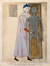 11486.Poster print.Decorative.Decoration art.Medieval surgery.Doctor office