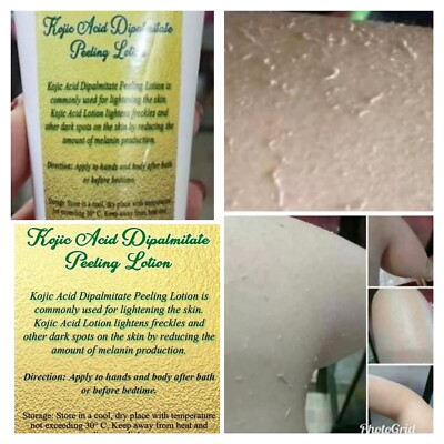 peeling lotion for face