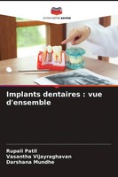 Rupali Patil (U. A.) | Implants Dentaires : Vue D'ensemble | Taschenbuch (2022)