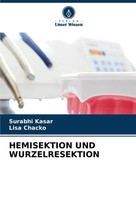 Surabhi Kasar (U. A.) | Hemisektion UND Wurzelresektion | Taschenbuch | Deutsch