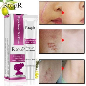 remove marks on face cream