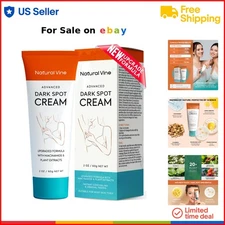 Dark Spot Corrector Cream Natural Brightening Age Spot Remover for Face Body