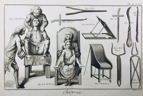 Cirugía De 1779 Médico Niños Del Raro Grabado Medicina Encyclopédie Diderot - Imagen 2 de 3