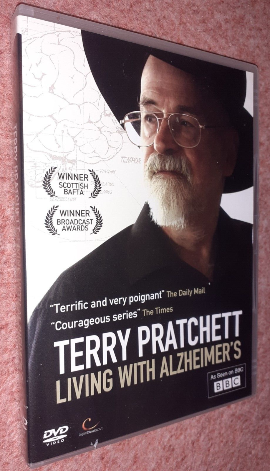 Terry Pratchett - Living With Alzheimer's ( Rare UK DVD, 2012) Documentary