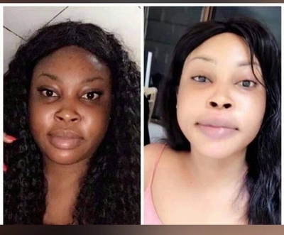 #ad #ad 🥰 BEST EXTREME whitening Face Soap no need face cream Result USA $16.45