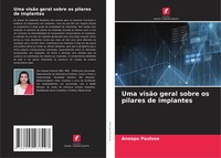 Anoopa Paulose | Uma VisãO Geral Sobre Os Pilares De Implantes | Taschenbuch
