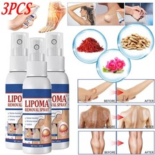 1-5PC Lipomheilung Reduction Spray,Instant LumpFree Lipoma Removal Spray USA Hot