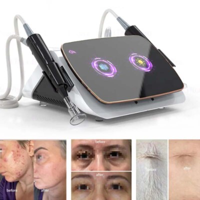 Plasma Spot Removal Cold Plasma Jet for Acne Wrinkles Bacteria Elimination