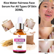 Rice Water Fairness Face Serum For All Types Of Skin Fades Acne Marks 30ML