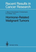 Hormone-Related Malignant Tumors Lutwin Beck