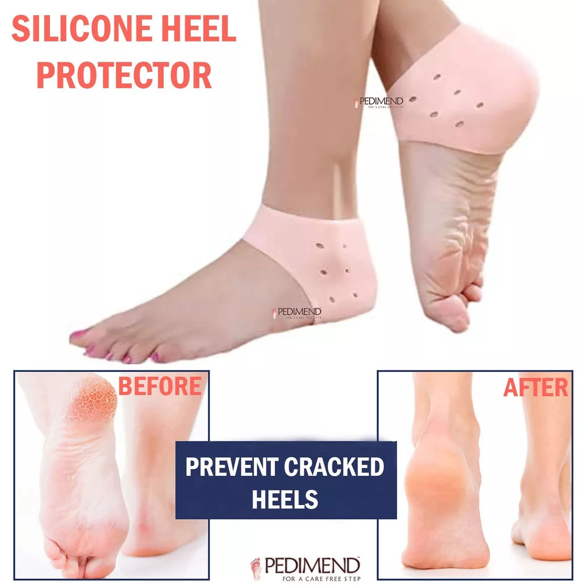 Heel spurs relief outlet