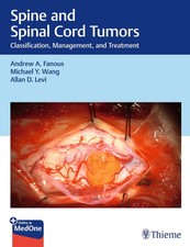 Spine and Spinal Cord Tumors | Classification...