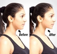 Chin & Neckline Slimmer Jaw Massager Reduces Double Chin Fat Lifts Face Exercise