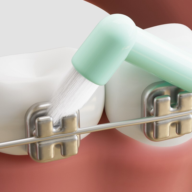 Orthodontic Toothbrush for Braces Double-Ended with Tufted Brush Soft Bristles