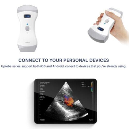 Sistema de diagnóstico por ultrasonido Doppler color doble sonda portátil CMS1600B-VET WIFI - Imagen 8 de 16