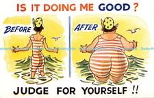 X000155 Is it doing me good. Before. After. Judge for Yourself. Bamforth. Seasid