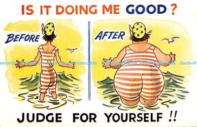 X000155 Is it doing me good. Before. After. Judge for Yourself. Bamforth. Seasid