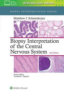 Biopsy Interpretation of the Central Nervous System by Matthew J. Schniederjan (