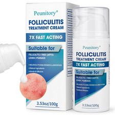 Folliculitis Treatment Cream - 5 Benzoyl Peroxide Treatment for Scalp, Body  B