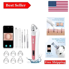 Sleek HD Blackhead Vacuum with Camera & 6 Heads